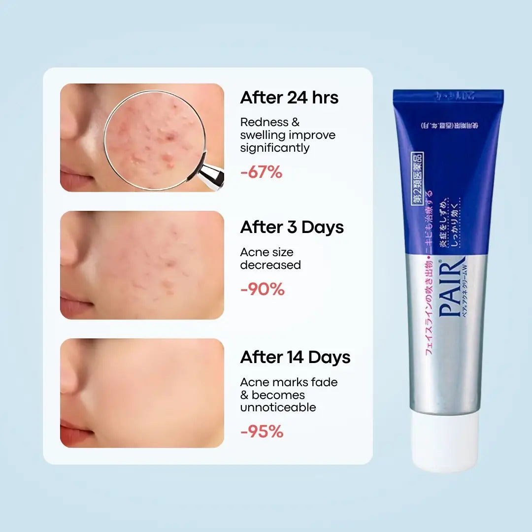 LION Medicated Pair Acne Cream 24g