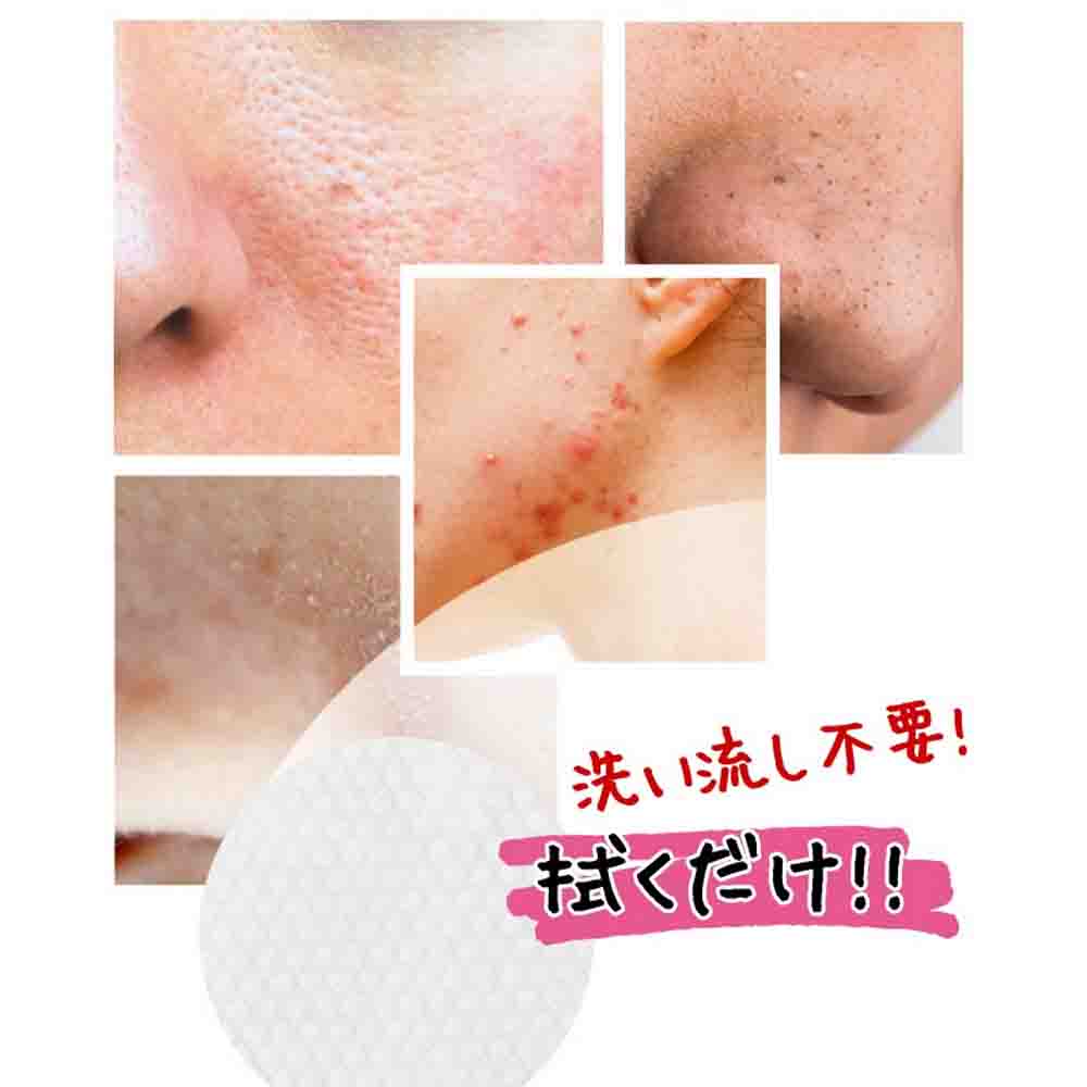 Cynet Mjcare Mild AHA+BHA+PHA Peeling Pad 70 sheets