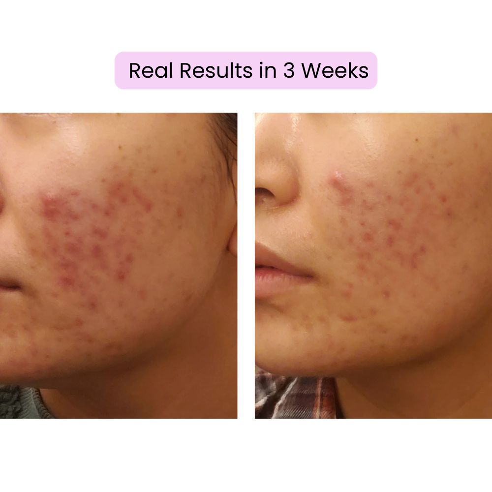 Rohto Melano CC Premium Vitamin C Essence 20ml